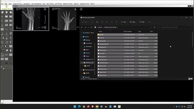 AmplifyPACS: How to open DICOM files from a CD and save them locally смотреть онлайн