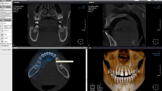 Xelis Dental Manipulations