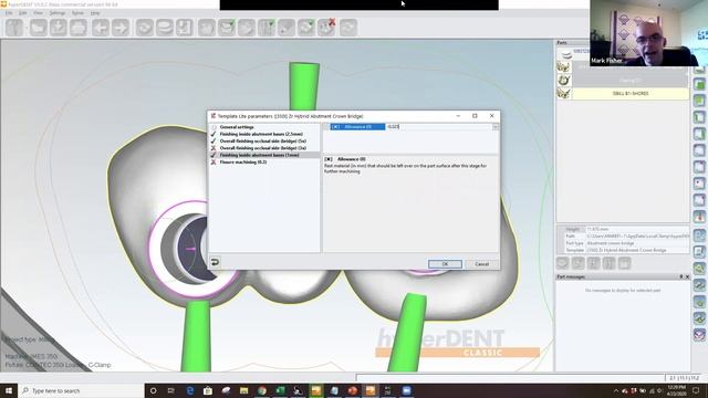 Quarantine Sessions 7 - HyperDENT Template Generator Lite