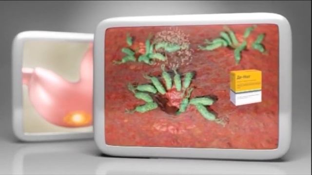 Смех и улыбки