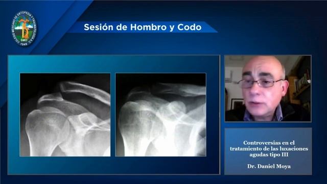 Controversias en el manejo de las luxaciones acromioclaviculares смотреть онлайн