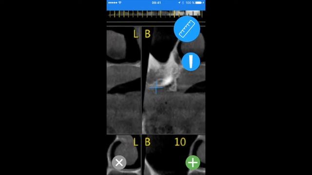 cbct ruler instruction guide iphone смотреть онлайн