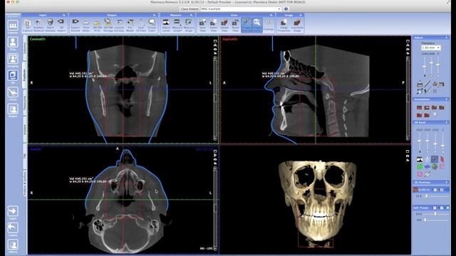 Romexis Airway Analysis смотреть онлайн