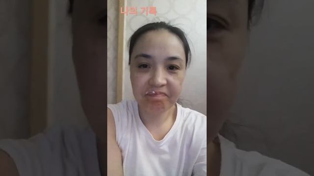 대상포진 예방접종 1차 선택진료 였다 смотреть онлайн