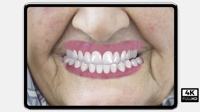 Smile Designer App 4K - AI Smile Design Software смотреть онлайн