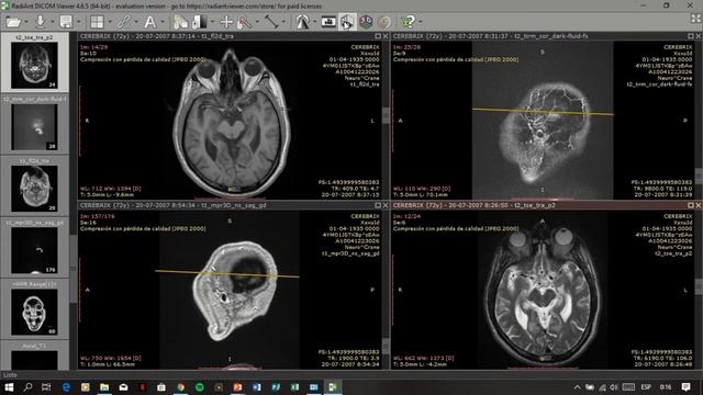 Tutorial RadiAnt DICOM Viewer