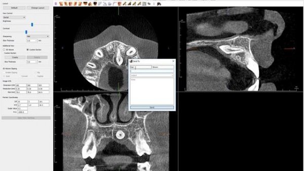 Invivo 6™ Tutorial - New Features in Invivo™ 6