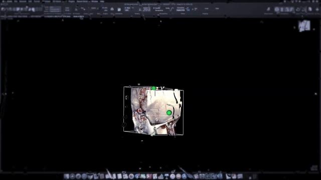 Horos Dicom Viewer in Action смотреть онлайн