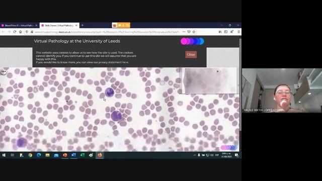 Hemograma Automatizado Tecnicas смотреть онлайн