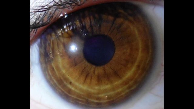 ✿ Iridology ✿ - Eye Review 10 ★★★★★ смотреть онлайн