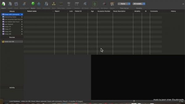 Miele LXIV DICOM Workstation and Viewer Mac App Store (Basic Overview)