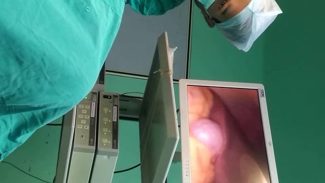 Karl Storz|Laparoscopy Unit|working Demonstration|karlstorz Co2 Insufflator, Karl Storz Camera