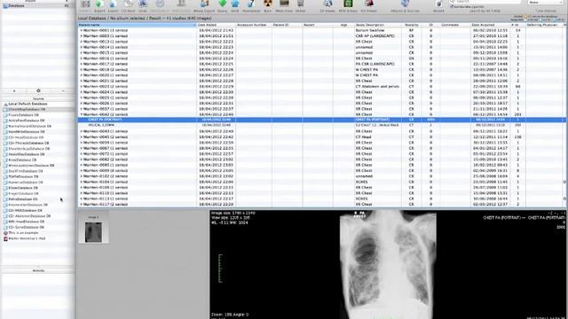 008 TransferDICOMfromMactoiPad смотреть онлайн
