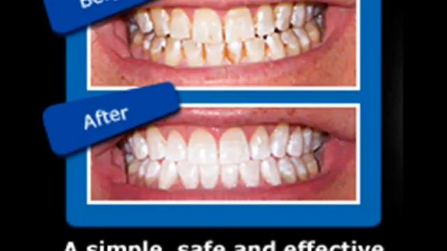 Dr. George Dental White Smile4u.wmv смотреть онлайн