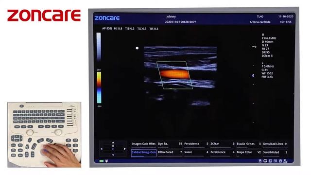 Flujo De Trabajo ZONCARE M5
