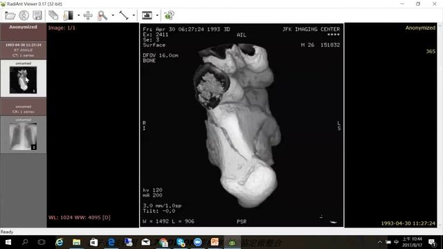 3 DICOM Viewer 使用說明 смотреть онлайн