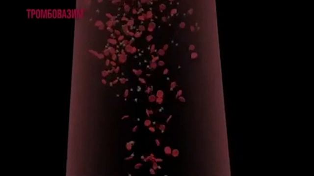ТРОМБОВАЗИМ простое решение в сложной ситуации! 13 октября Всемирный день тромбоза!