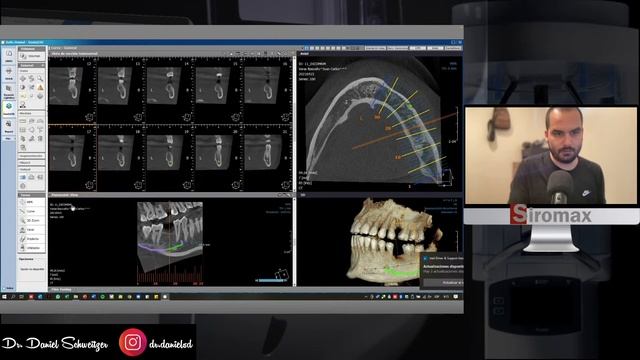 Xelis Dental Paso a Paso Parte 1: Herramientas básicas y Report смотреть онлайн