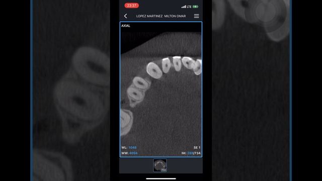 Como visualizar una Tomografía Dental (CBCT) en tu celular android o iphone смотреть онлайн