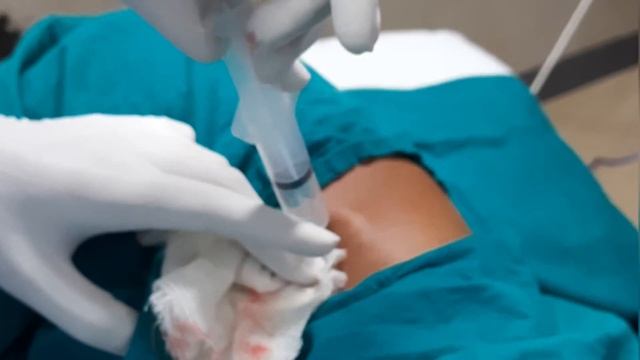 Intercostal Tube Drainage-A Live Demonstration in Patient (Hindi) (Chest Drain/ ICTD) # Chest Tube смотреть онлайн