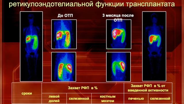 Лекция 6-7 курс. МГМСУ История отечественной трансплантологии , Трансплантология сегодня смотреть онлайн