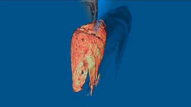 MicroCT study of the egg (nit) and mature embryo of the human lice (High def.) смотреть онлайн