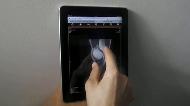 HTML5 iPad DICOM Viewer смотреть онлайн