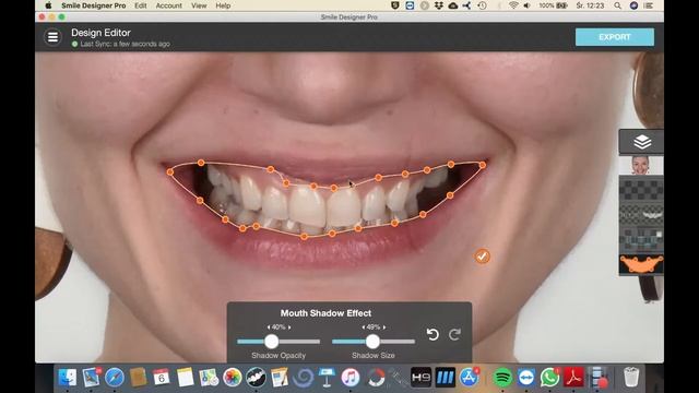Digital Dental Education Smile Designer Pro Set Up Tutorial смотреть онлайн