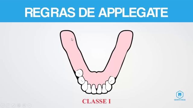 CLASSIFICAÇÃO DE KENNEDY & REGRAS DE APPLEGATE | ODONTO DICAS смотреть онлайн