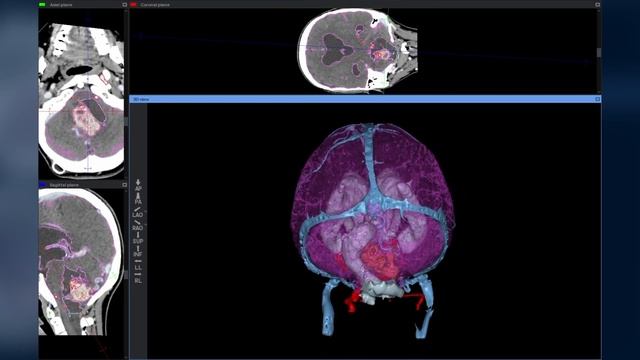 Краткий обзор основных возможностей Inobitec DICOM Viewer