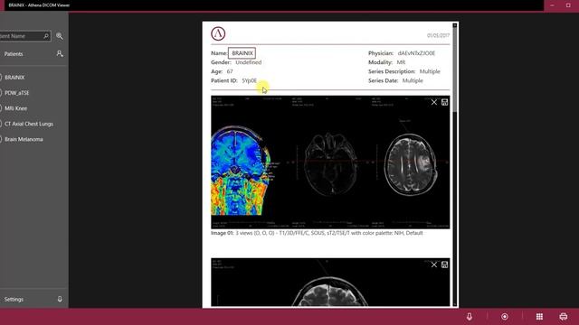 Report - Athena DICOM Viewer смотреть онлайн