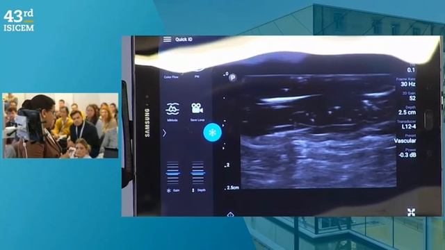 TRANSCRANIAL DOPPLER FOR THE NON EXPERT ISICEM 2024 смотреть онлайн