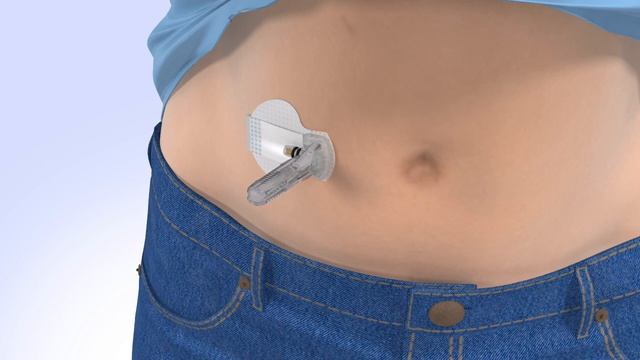 Inserting the Guardian™ Sensor 3 with the MiniMed™ 670G System смотреть онлайн