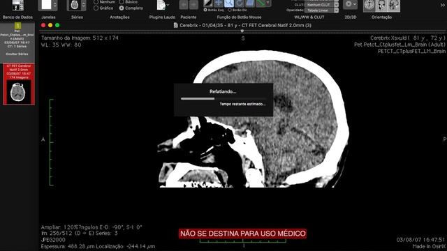 Imagens em 3D no osirix смотреть онлайн