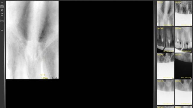 Developing dental medical application for touch display using Adobe AIR смотреть онлайн
