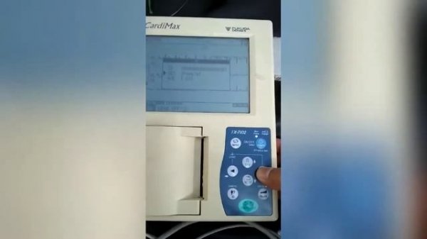 ECG FUKUDA DENSHI CARDIMAC FX-7102