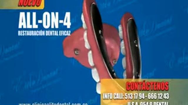 elite dental all on 4 casos de exito смотреть онлайн