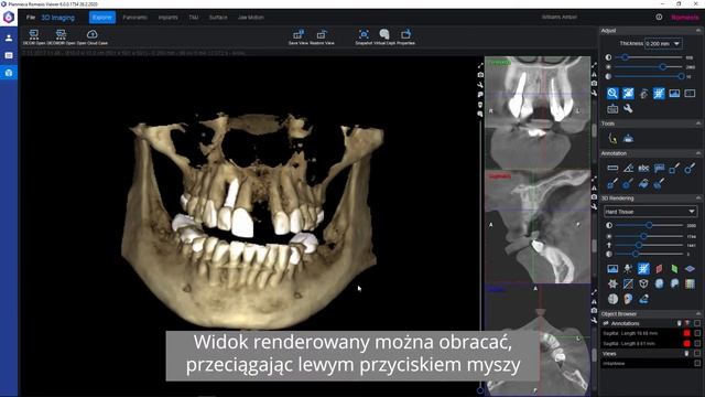Korzystanie z przeglądarki Planmeca Romexis Viewer смотреть онлайн