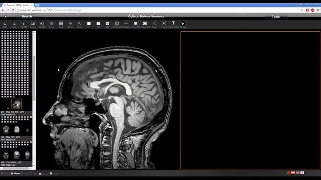 Radiology Web Viewer смотреть онлайн
