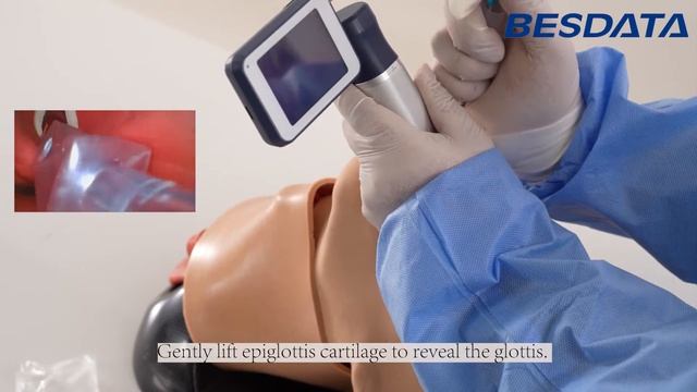 How to use disposable video laryngoscope for anesthesia intubation смотреть онлайн