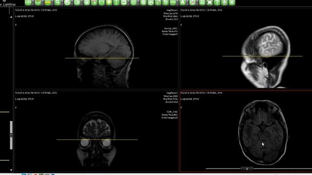 MedPac Systems Web Based PACS Dicom Viewer MRI Scout/Localizer/Reference Lines смотреть онлайн