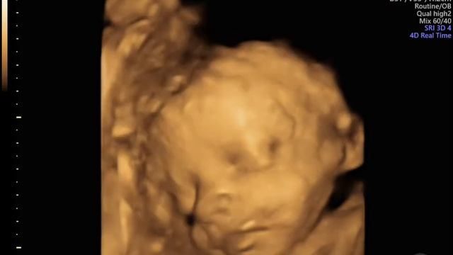 4D плода 29 недель