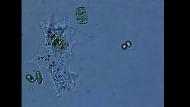 "The Hunter" Amoeba in brightfield 2 смотреть онлайн
