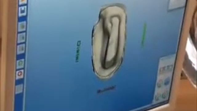 CAD-CAM-FRESADO-DENTAL-CENTROS MECANIZADOS-Dental-Milling-CNC-.wmv смотреть онлайн