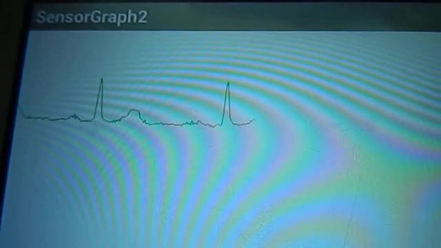 Android based health monitoring system смотреть онлайн