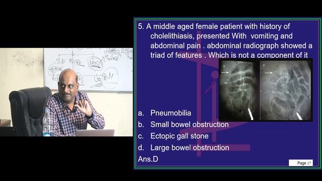 NEETPG Next 2020 Image based MCQ Quiz Daily 04 Part 01 смотреть онлайн
