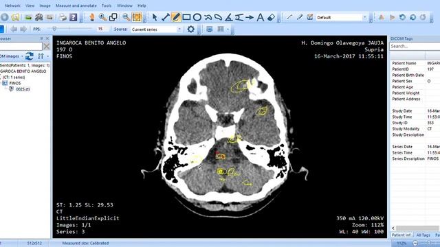 MicroDicom viewer 64 bit unlicensed for commercial use 0025 2021 12 27 00 06 50 смотреть онлайн