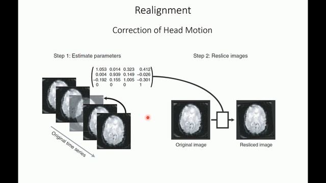 fMRI data preprocessing смотреть онлайн