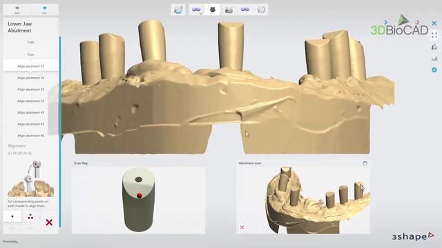 3DBioCAD - 3Shape Dental System Wax up Implant Bridge Scanning Workflow смотреть онлайн