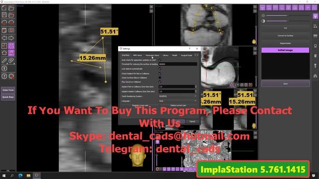 ImplaStation 5.761 (2021) смотреть онлайн